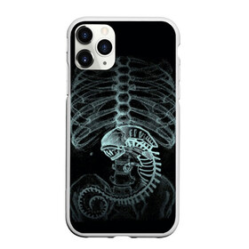 Чехол для iPhone 11 Pro матовый с принтом Чужой на Рентгене в Екатеринбурге, Силикон |  | alien | больница | больной | внутренний мир | врач | клиника | кости | пациент | ребра | рентген | скелет | снимок | хищник