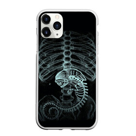 Чехол для iPhone 11 Pro Max матовый с принтом Чужой на Рентгене в Екатеринбурге, Силикон |  | alien | больница | больной | внутренний мир | врач | клиника | кости | пациент | ребра | рентген | скелет | снимок | хищник