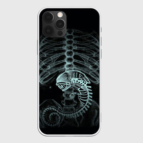 Чехол для iPhone 12 Pro Max с принтом Чужой на Рентгене в Екатеринбурге, Силикон |  | alien | больница | больной | внутренний мир | врач | клиника | кости | пациент | ребра | рентген | скелет | снимок | хищник
