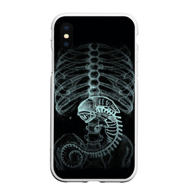 Чехол для iPhone XS Max матовый с принтом Чужой на Рентгене в Екатеринбурге, Силикон | Область печати: задняя сторона чехла, без боковых панелей | alien | больница | больной | внутренний мир | врач | клиника | кости | пациент | ребра | рентген | скелет | снимок | хищник