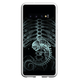 Чехол для Samsung Galaxy S10 с принтом Чужой на Рентгене в Екатеринбурге, Силикон | Область печати: задняя сторона чехла, без боковых панелей | alien | больница | больной | внутренний мир | врач | клиника | кости | пациент | ребра | рентген | скелет | снимок | хищник